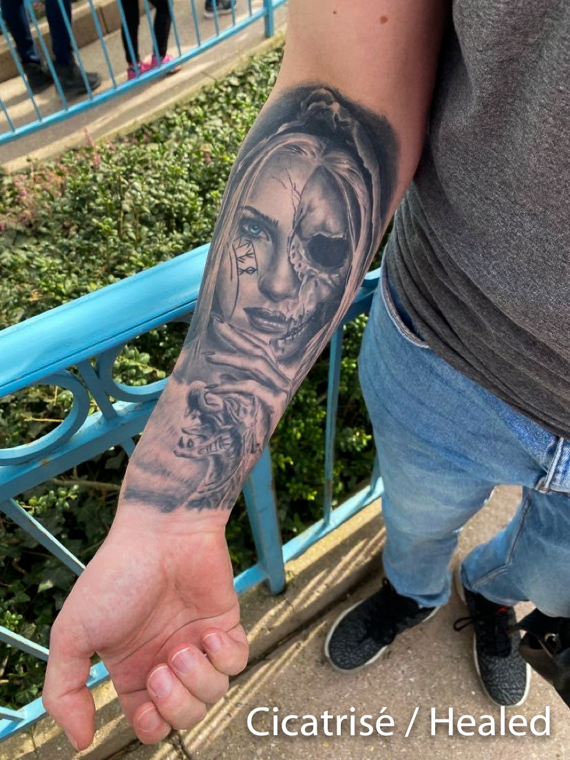 cicatrisation tatouage